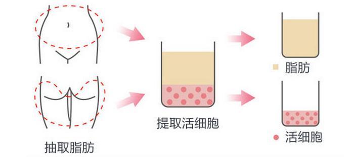 合肥智善美医疗美容怎么样？术后过程&科普问答