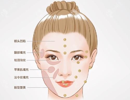 上海华美医疗美容医院做鼻部整形技术怎么样?张朋医生介绍_鼻部整形案例问答