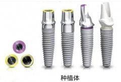 南昌牙齿种植价格表20