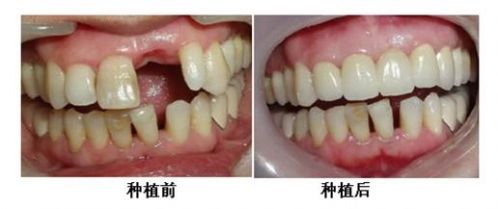 南京雅康口腔弗朗西斯科