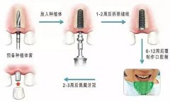 2026荆门牙齿种植价格表