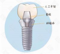 2026郑州林则口腔门诊种