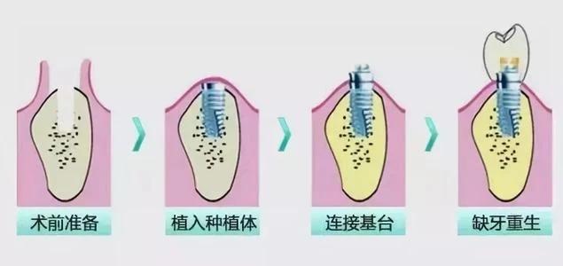 太原哪家口腔医院口碑好