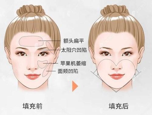 哈尔滨超龙医疗美容医院正规吗?医院详细资料、技术优势与真实案例解析