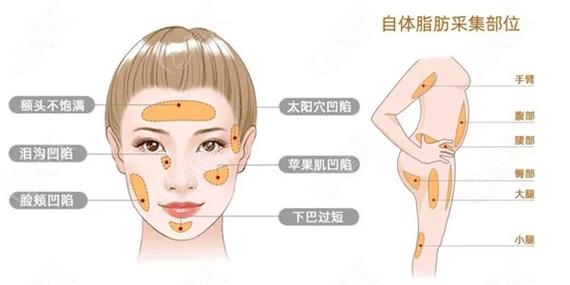 杭州洁铭威塑医疗美容医院信息分享,内附整形问答+案例分析