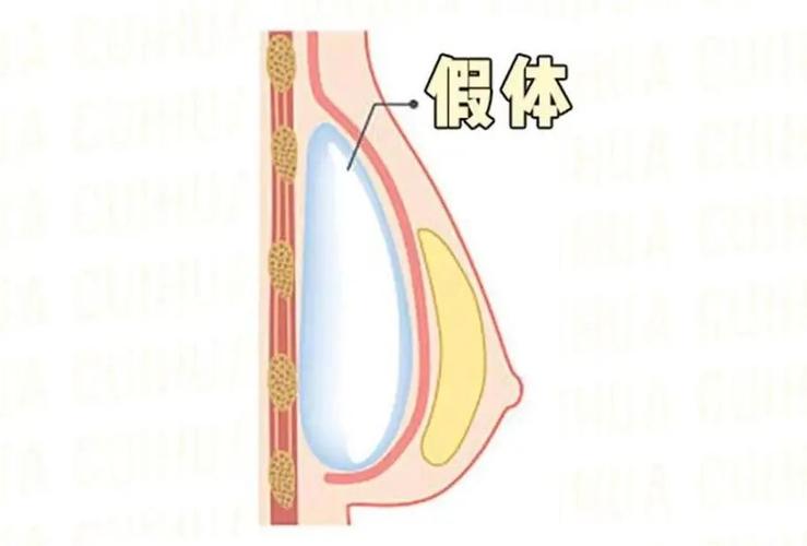 海口自体脂肪填充哪家医院更专业?兰颜慧、曙光梦妮幻值得关注